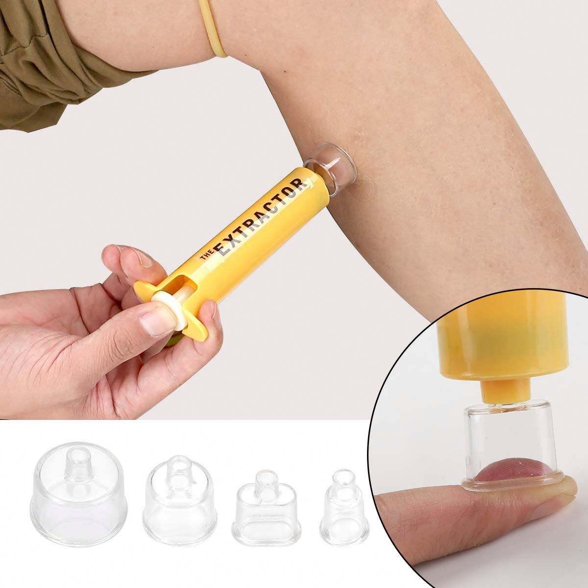 Snake Bite Kit Venom Extractor Pump Bee Sting Emergency First Aid Suction Tools